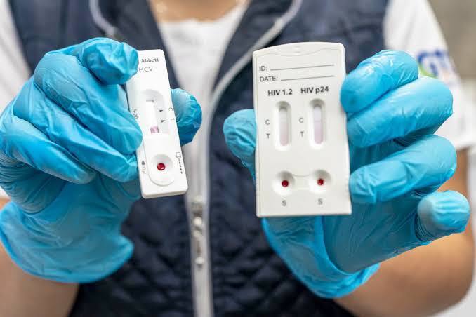 Garantizan tratamientos antirretrovirales y pruebas rápidas en CAPASITS y unidades de salud de Veracruz